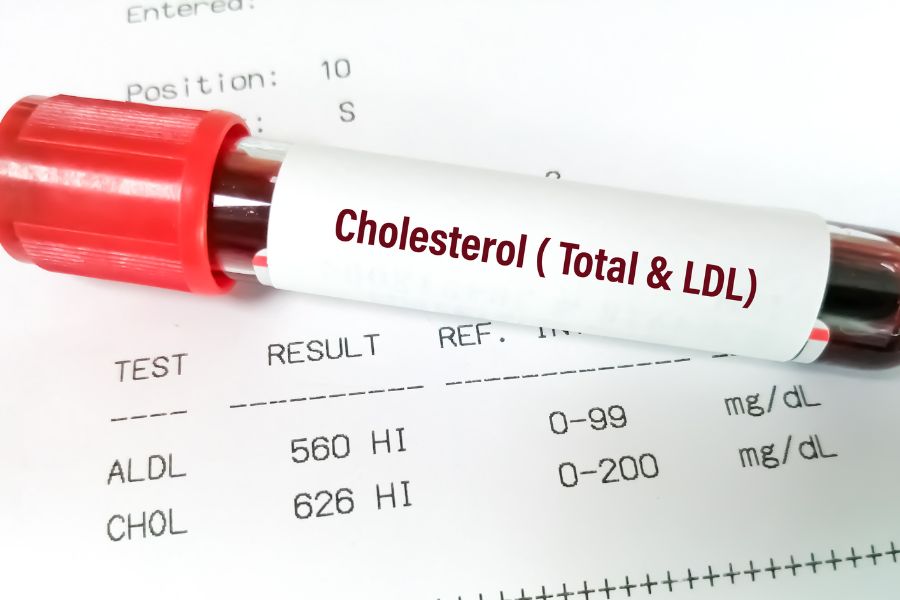 kolesterol darah