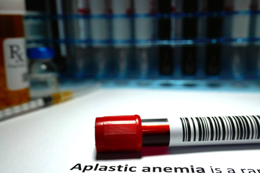 Anemia aplastik