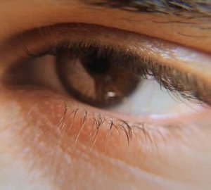 Sleepy Eyes: Penyebab dan Cara Mengatasinya