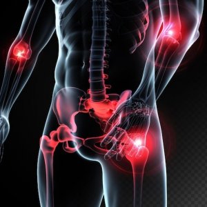 Pubalgia Adalah Cedera Panggul yang Wajib Diwaspadai!