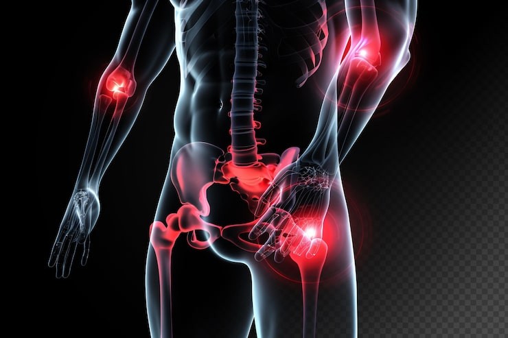 Pubalgia adalah salah satu jenis cedera.