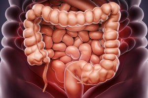Ilustrasi hasil detox usus.