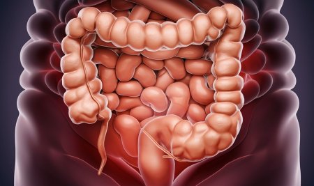 Cara Detox Usus yang Mudah Dilakukan