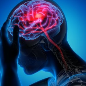 Sakit Kepala? Begini Cara Mengatasinya Tanpa Obat