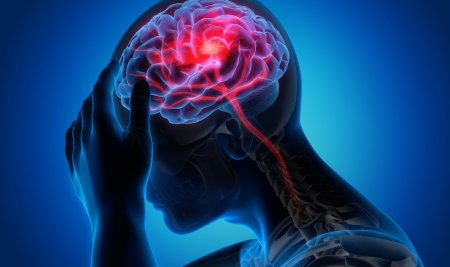 Sakit Kepala? Begini Cara Mengatasinya Tanpa Obat