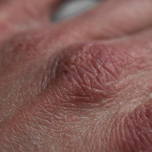 Alami Kulit Kering? Ini Tips Alami Agar Tetap Lembap