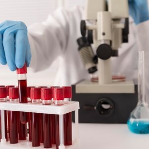 Mengenal Warna Darah, Sehat atau Tidak?