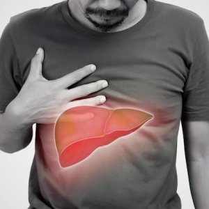 Mengenal Fatty Liver: Gejala, Penyebab, dan Cara Mengatasinya