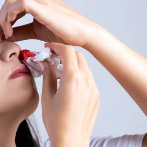 Apa yang Jadi Penyebab Mimisan Terus Menerus?
