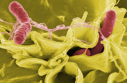 Demam tifoid adalah demam yang disebabkan bakteri Salmonella enterica serovar Typhi.